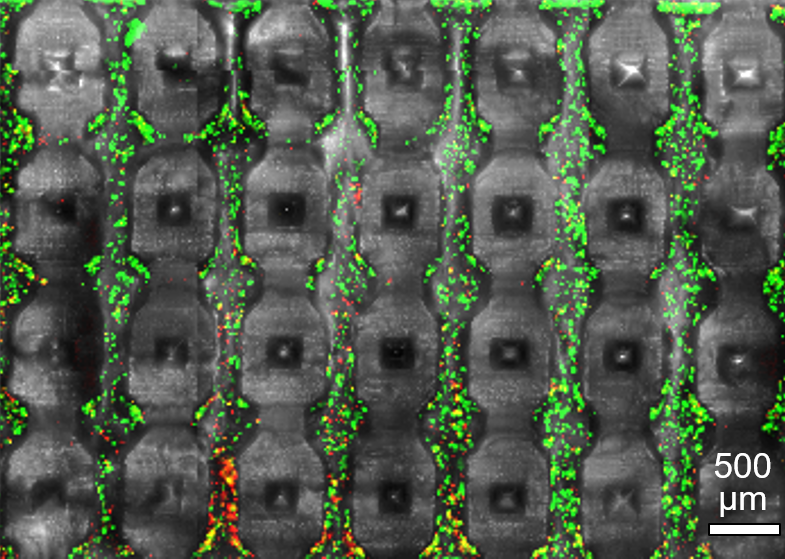 Cross-sectioned 3D printed microfluidic channel array (gray) supporting 3D culture of live cells (green) at high cell densities.